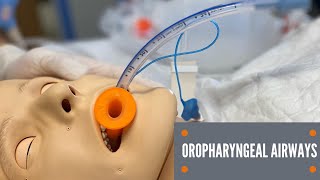 Oropharyngeal Airway Insertion [upl. by Yrol]