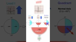 How to identify an axis deviation on an EKG ￼ [upl. by Lokin]