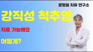 강직성 척추염  자가면역 질환이 치료가 가능하다고 어떻 [upl. by Rich499]