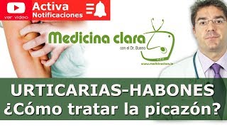 Urticaria habones y ronchas Cómo evitar y tratar una picazón  Medicina Clara [upl. by Notnirb710]