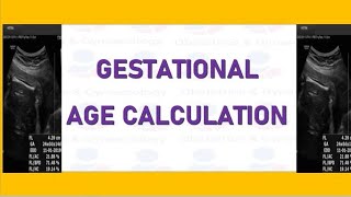 How to Measure Gestational Age with the Help of Multiple Ultrasound Parameters [upl. by Lanae]