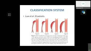 Mesenteric Arterial Dissection  Mesenteric Vascular Disease Venous Thrombosis [upl. by Nollahs855]