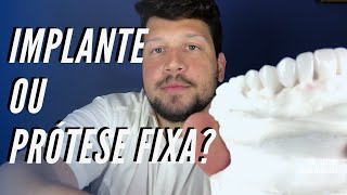 Implante ou prótese fixa  Dr Victor Hugo Almeida [upl. by Lotte]