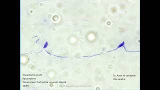 Toxoplasma gondii Tachyzoites [upl. by Oys]