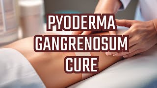 Treatment of Pyoderma gangrenosum [upl. by Akeber]