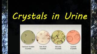 Urine Examination3 Crystals [upl. by Ratcliffe]