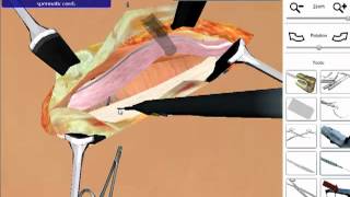 Hernia Repair  Open Surgery Simulation [upl. by Erej]