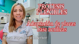 Recorte y adaptación de placas base en modelos Duplicados para PROTESIS FLEXIBLES caso supinf [upl. by Notlih]