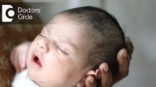 How to ensure right shape of head in newborns  Dr Varsha Saxena [upl. by Neddra20]