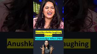 Laughing Disease  Pseudobulbar affect  ye kya hai [upl. by Favin430]