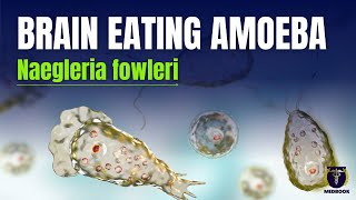 Naegleria fowleri  Brain eating amoeba  How to stay safe [upl. by Sharla647]