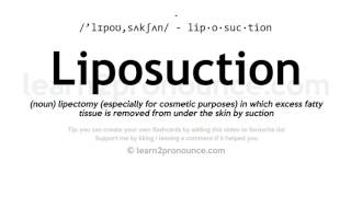 Pronunciation of Liposuction  Definition of Liposuction [upl. by Beret92]