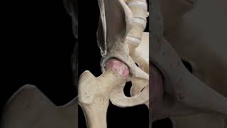 🦴 Hip Arthrosis When the Hip Joint Wears Down anatomy [upl. by Artenak]