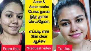 How I cleared my acne  My skincare routine for Acne amp Acne marks  Best products for pimple skin [upl. by Gorga]