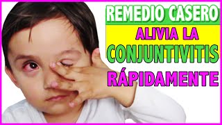 Alivia la CONJUNTIVITIS con éste remedio casero rápido y efectivo [upl. by Prescott]