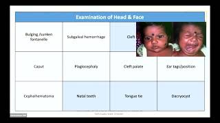 Targeted Neonatal Examination in Busy Practice  Dr V Anand [upl. by Gibbon]