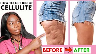 How to get rid of CELLULITE on your THIGHS LEGS amp BUTT Home Remedies Workout  Creams amp more [upl. by Chrysler]