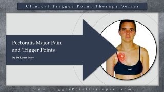 Pectoralis Major Pain and Trigger Points [upl. by Ikin992]