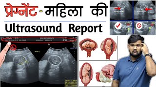 Pregnancy Ultrasound  Ultrasound Report  Medical  Doctor  MBBS  BHMS  BAMS  Nursing [upl. by Venable]