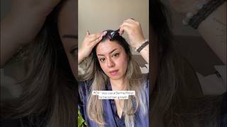 Derma Roller hair growth results are amazing Hair regrowth journey with derma roller 05 haircare [upl. by Yrellav]