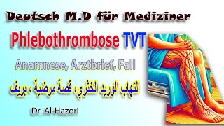 Arztbrief Anamnese und Fall der Phlebothrombose TVT القصة المرضية والبريف في التهاب الوريد الخثري [upl. by Eleazar681]