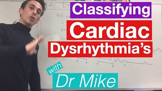 Cardiac dysrhythmias arrhythmias common [upl. by Enialedam614]