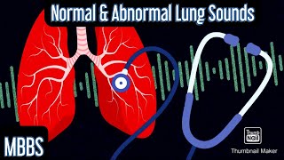 Normal amp Abnormal Lung sounds Wheeze Rhonchi Crepitus Stridor mbbs medicine neetpg [upl. by Alyar716]