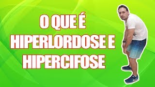 O QUE É HIPERLORDOSE E HIPERCIFOSE [upl. by Melvin]