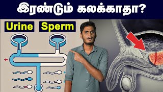 ஆண்கள் கட்டாயம் தெரிந்து வைத்திருக்க வேண்டிய உறுப்பு  Prostate gland  working amp mechanism [upl. by Castorina]