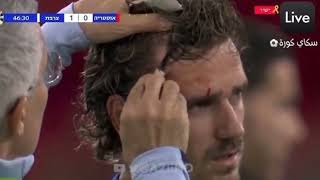 🇫🇷 Frances Antoine Griezmann bleeding after painfully colliding with advertising board vs Austria [upl. by Mccarty34]