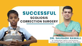 Congenital Scoliosis Successful Surgery  Patient Dev  Congenital Scoliosis Treatment [upl. by Woodward567]