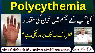 Polycythemia خون کی مقدار بڑھ جانا पॉलीसिथेमिया Homeopathic Treatment In Urdu  Hindi [upl. by Boarer]