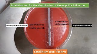 Satellitism Test for Identification of Haemophilus influenzae Satellitism Test Positive [upl. by Adnolaj]