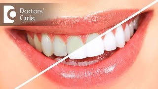 Teeth cleaning vs teeth whitening  Dr Sumanth M Shetty [upl. by Vories]