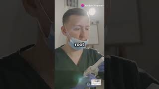 What is RCT root canal treatment How and why its done Simple explanation video for patient nopain [upl. by Esihcoc]