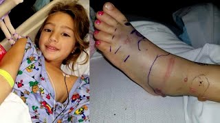 Brave 5YearOld Recovers in Hospital From Venomous Snake Bite [upl. by Leodora]