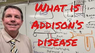 What is Addison’s Disease [upl. by Amyaj]