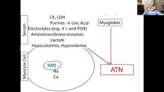 Rhabdomyolysis Arabic Language  Dr Gawad [upl. by Soigroeg]