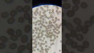 Looking at Mushroom Spores Under a Microscope shorts shortvideo microscope mushroom spore [upl. by Shermy]