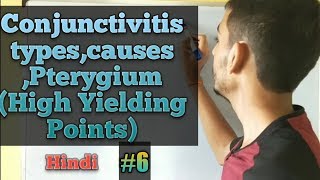 Conjunctiva anatomyConjunctivitishindi Pterygium vs Pinguecula Ophthalmology lectures in hindi [upl. by Alletse779]