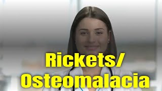 What is Rickets and Osteomalacia Symptoms Causes and Treatment [upl. by Aushoj394]