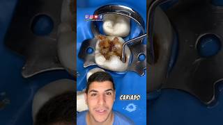 Você já teve dor de dente dentes curiosidades dentista dentesbrancos dicas dentadura [upl. by Adalie]