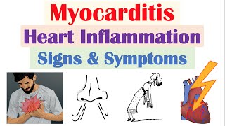 Myocarditis Heart Inflammation Signs amp Symptoms amp Why They Occur [upl. by Carmelia]