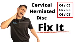 Cervical herniated disc exercises [upl. by Erdnassac]