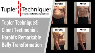 Tupler Technique® Client Testimonial Harolds Remarkable Belly Transformation [upl. by Siramed]