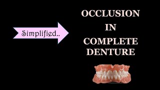 OCLUSION IN COMPLETE DENTURE  BALANCED OCCLUSION [upl. by Gavini]