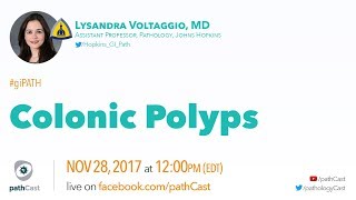 Colonic polyps  Dr Voltaggio Hopkins GIPATH [upl. by Proffitt]