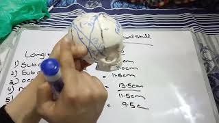 Diameter of fetal skull [upl. by Longmire896]