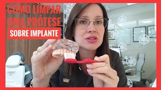 COMO LIMPAR UMA PRÓTESE SOBRE IMPLANTE DRA DANIELLE SALES [upl. by Carleton]