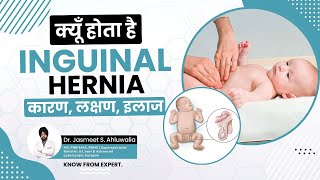 What is Inguinal Hernia Causes and Symptoms Treatment  बच्चों में अंडकोष हर्निया  लक्षण कारण [upl. by Octavus]